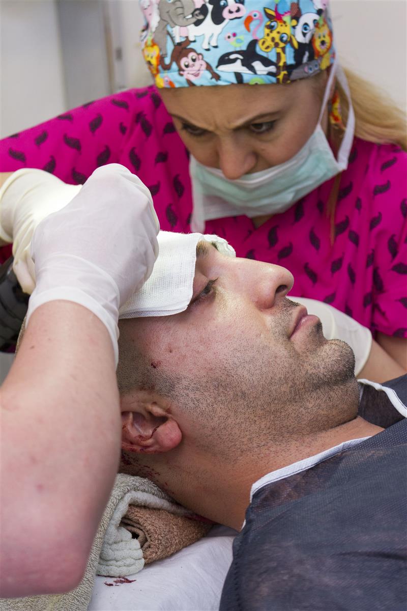 Force Hair Transplant