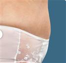 Tummy Tuck (Abdominoplasty) - Estethica Surgical Medical Center