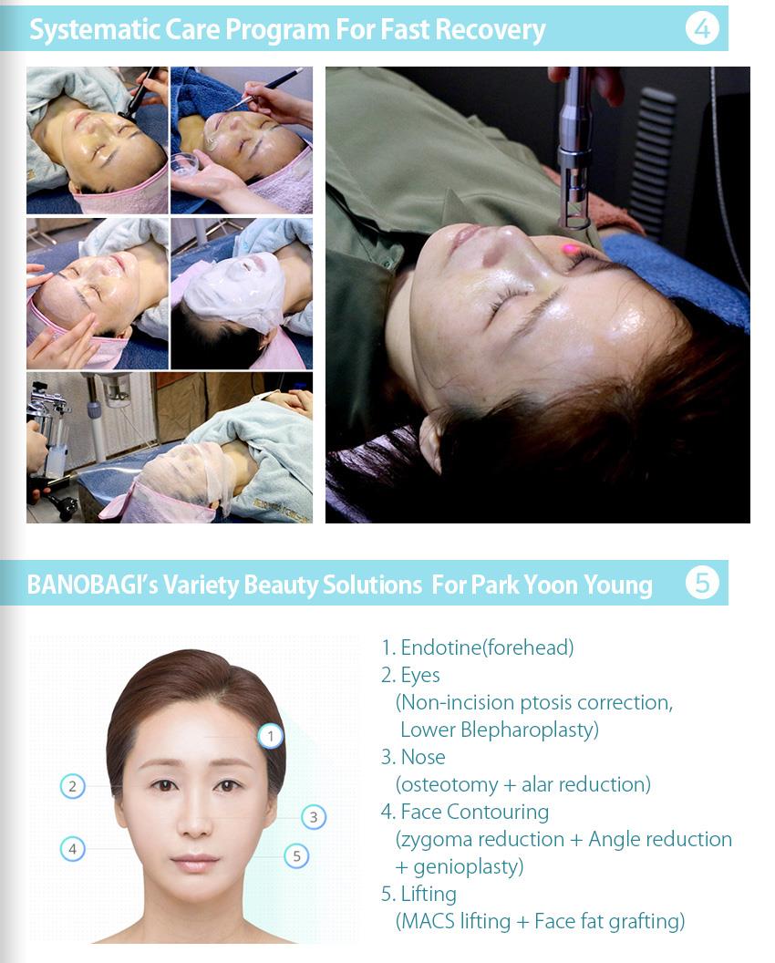 Banobagi Plastic Surgery