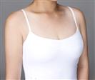 Breast Lift - Banobagi Plastic Surgery