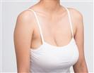 Breast Lift - Banobagi Plastic Surgery