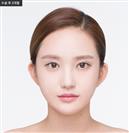 Genioplasty - Banobagi Plastic Surgery