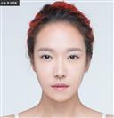 Genioplasty - Banobagi Plastic Surgery