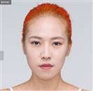 Genioplasty - Banobagi Plastic Surgery