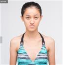 Genioplasty - Banobagi Plastic Surgery