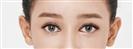 Eye Plastic Surgery - Banobagi Plastic Surgery