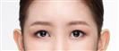 Eye Plastic Surgery - Banobagi Plastic Surgery