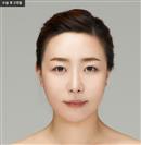 Facelift - Banobagi Plastic Surgery