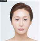 Facelift - Banobagi Plastic Surgery