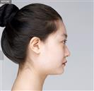 Forehead Volume - Banobagi Plastic Surgery