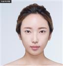 Zygoma Reduction - Banobagi Plastic Surgery