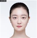 Square Jaw Reduction - Banobagi Plastic Surgery
