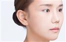 Rhinoplasty - Banobagi Plastic Surgery