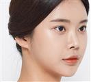 Rhinoplasty - Banobagi Plastic Surgery