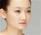Rhinoplasty - Banobagi Plastic Surgery