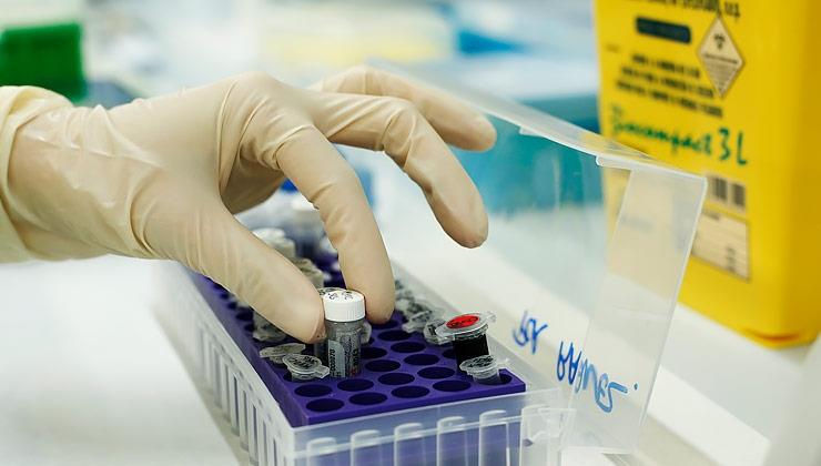 Instituto de Microcirugía Ocular (IMO Barcelona)