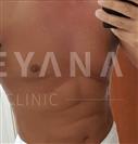 Six Pack - Turkeyana Clinic