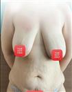 Breast Lift - Liposuction - Abdominal Etching - Turkeyana Clinic