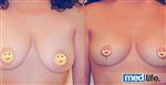 Breast Uplift - Medlife Group