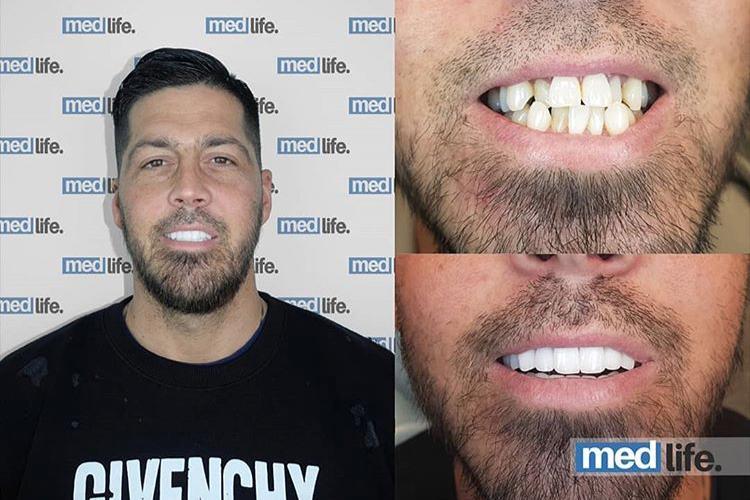 Dental - Medlife Group