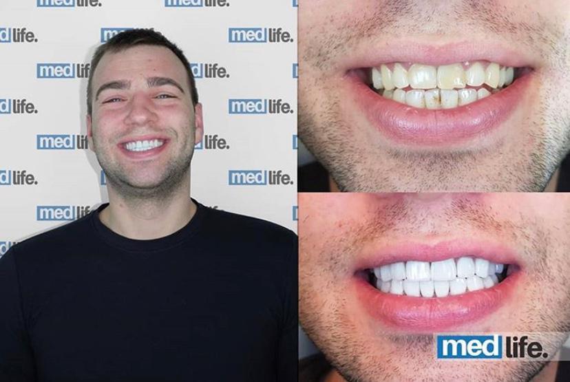 Dental - Medlife Group