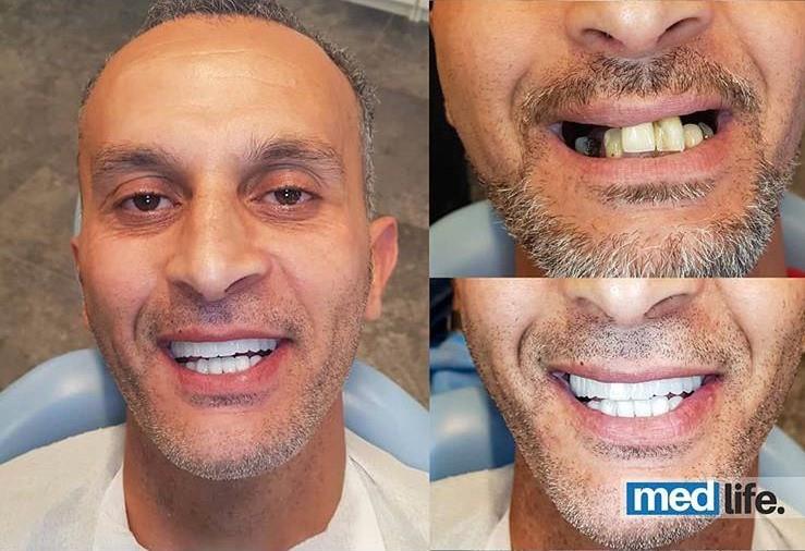 Dental - Medlife Group