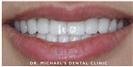 Couture Smile - Dr. Michael’s Dental Clinics