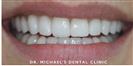 Couture Smile - Dr. Michael’s Dental Clinics