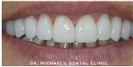 Couture Smile - Dr. Michael’s Dental Clinics