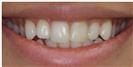 Couture Smile - Dr. Michael’s Dental Clinics