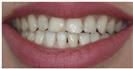 Couture Smile - Dr. Michael’s Dental Clinics