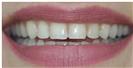 Couture Smile - Dr. Michael’s Dental Clinics