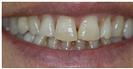 Couture Smile - Dr. Michael’s Dental Clinics