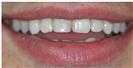 Couture Smile - Dr. Michael’s Dental Clinics