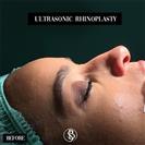 Rhinoplasty - Dr. Salih Onur Basat Clinic