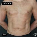 Six-Pack - Dr. Salih Onur Basat Clinic
