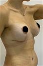 Breast Lift - ADATIP Hospital