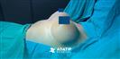 Breast Augmentation - ADATIP Hospital