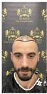 FUE Hair Transplant - ADATIP Hospital