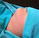 Double Chin Surgery - TWT Health Tourism