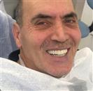 Dental Implant - TWT Health Tourism