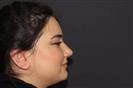 Rhinoplasty - TWT Health Tourism