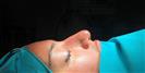 Rhinoplasty - TWT Health Tourism