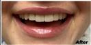Periodontics - Fulop Clinic
