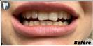 Periodontics - Fulop Clinic