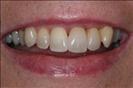 Herzliya Dental Clinic