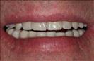 Herzliya Dental Clinic