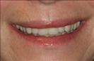 Herzliya Dental Clinic