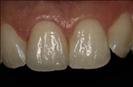 Herzliya Dental Clinic