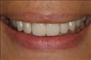 Herzliya Dental Clinic